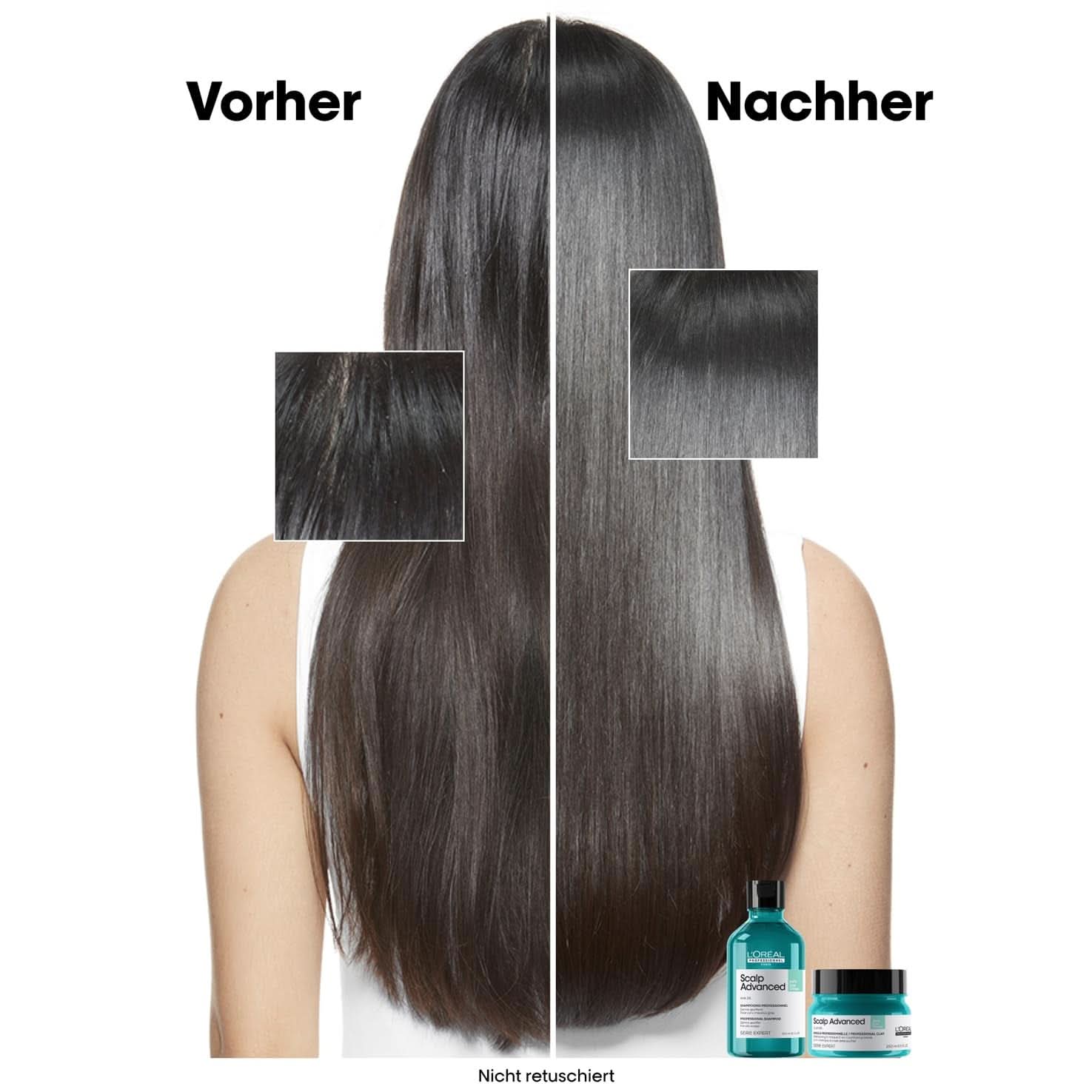 L'Oréal Professionnel Vette hoofdhuidreinigingsshampoo, 300 ml Naty Shop Douche en bad