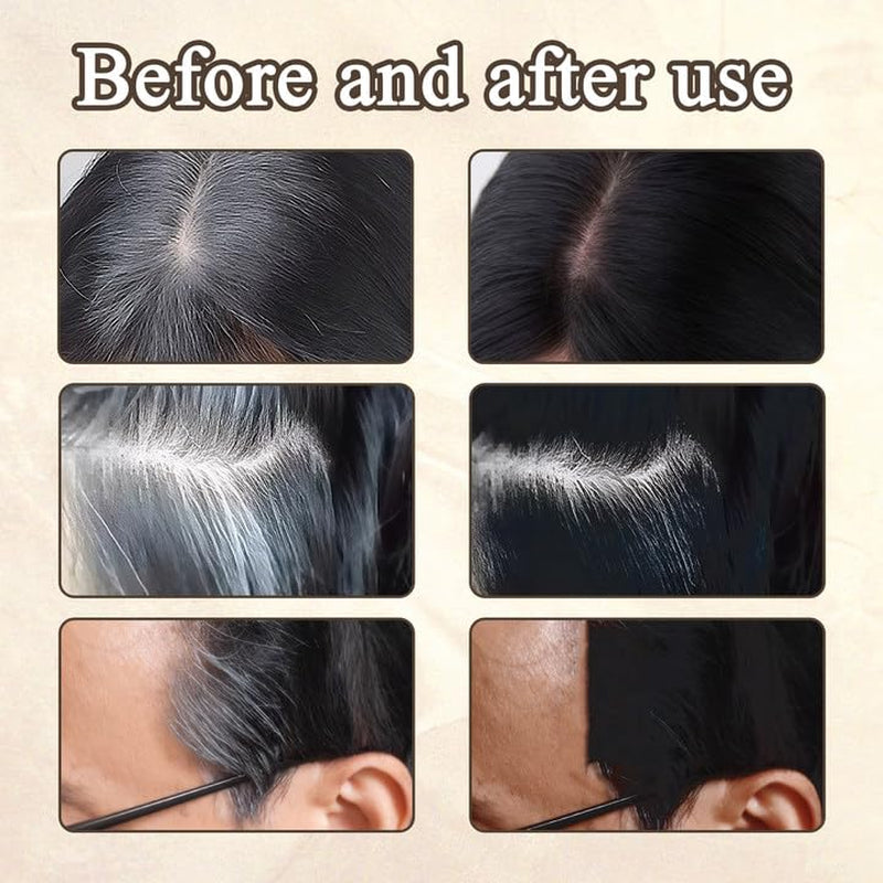2 stuks donkerbruin haarlijnpoeder, haarlijnpoeder, haarlijnconcealer, haarkleurpotloden met kam, grijs haarafdekkingshulpmiddel voor dames en heren (40 g, donkerbruin) Naty Shop haarverf