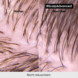 L'Oréal Professionnel Vette hoofdhuidreinigingsshampoo, 300 ml Naty Shop Douche en bad