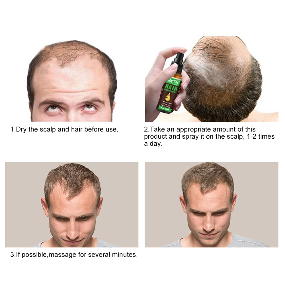 Haargroei, Anti Haaruitval, Haargroeispray, Haaruitval en Haarbehandeling, voor dunner wordend haar, Bevordert dikkere, vollere en snellere haargroei, 60ml Haarverzorging Naty Shop