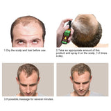 Haargroei, Anti Haaruitval, Haargroeispray, Haaruitval en Haarbehandeling, voor dunner wordend haar, Bevordert dikkere, vollere en snellere haargroei, 60ml Haarverzorging Naty Shop