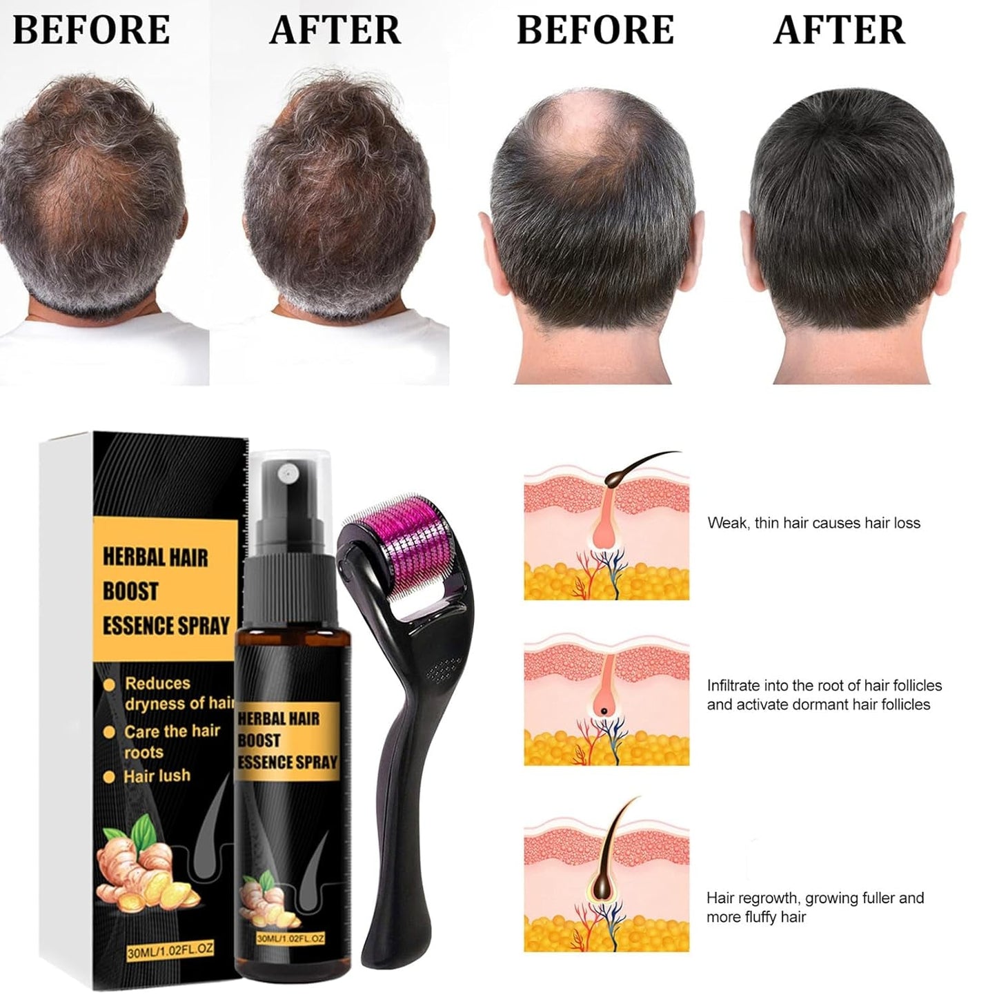 Geavanceerde haargroeibehandelingskit 30 ml 2 STUKS Haargroeispray Haargroeiroller en essentieset Haargroeiserum Anti-haaruitval Geavanceerd haargroeiserum Haarverzorging Naty Shop