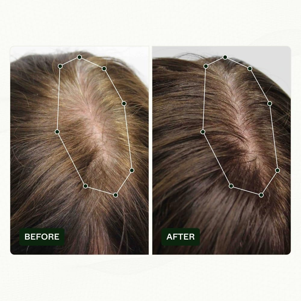 Scandinavische Biolabs haargroeiroutine voor vrouwen met klinisch bewezen resultaten in 45 dagen | Behandeling van haaruitval (Bio-Pilixin) Naty Shop Haarverzorging