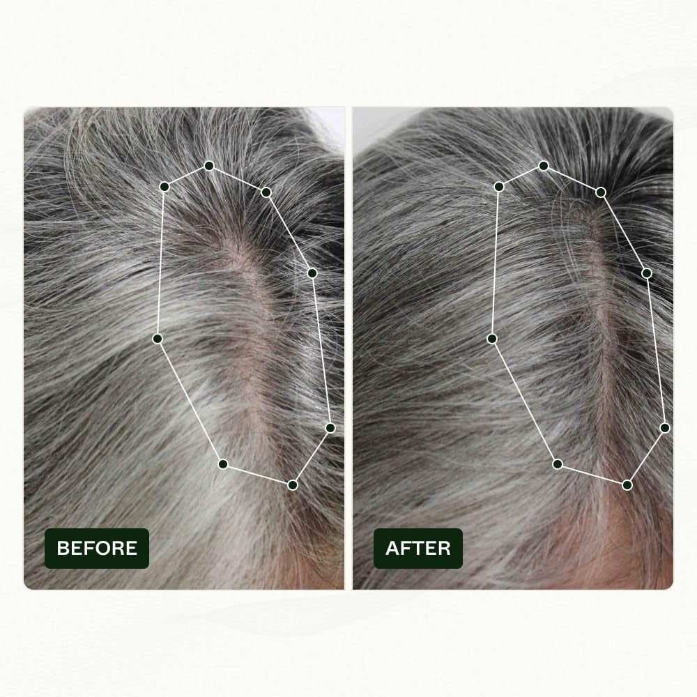 Scandinavische Biolabs haargroeiroutine voor vrouwen met klinisch bewezen resultaten in 45 dagen | Behandeling van haaruitval (Bio-Pilixin) Naty Shop Haarverzorging