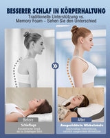Nekkussen Orthopedisch kussen voor nekpijn Memory Foam kussen Ergonomisch kussen voor optimale ondersteuning Neksteunkussen voor laterale rug- en buiksteunen Cervicale orthopedische kussens Naty Shop