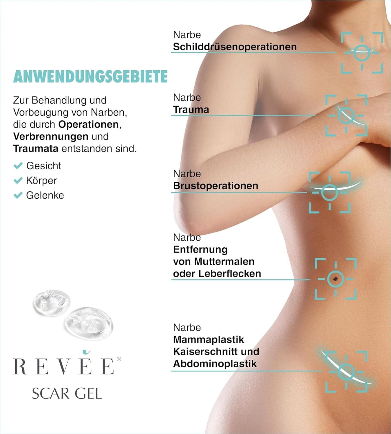 Revée Scar Gel, actuele gel voor littekens Naty Shop