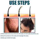 Miioto Haargroeiserum Haargroeiproduct voor mannen Haargroei Haarserum Hoofdhuidverzorging Dikker haar bevorderen Hoofdhuid voeden Haaruitval voorkomen 3*60ML Haarverzorging Naty Shop