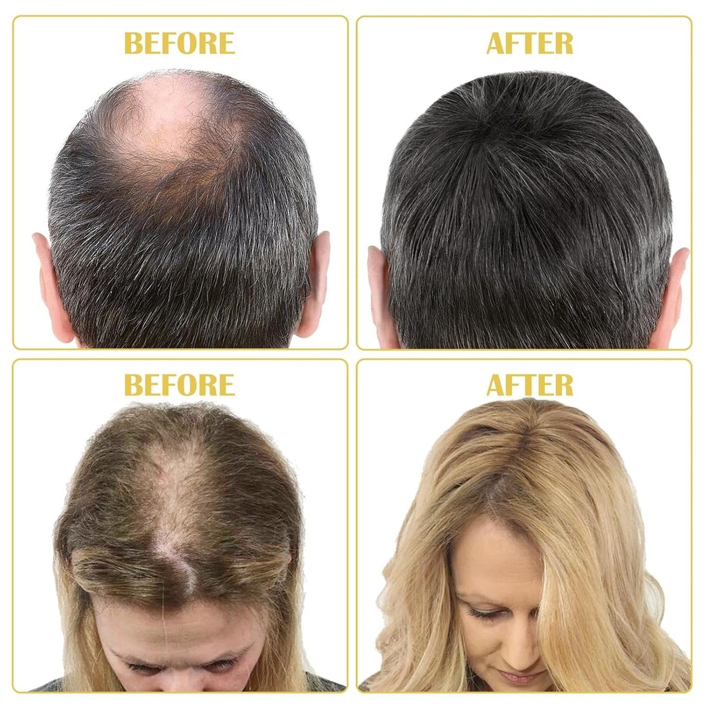 Biologische haargroeiolie 5% - Oplossing voor extern gebruik - Haargroei en verdikking - Voor haarverlies bij mannen en dunner wordend haar - Reactiveert krimpende follikels - Nauwkeurige pompdispenser, 60 ml haarverzorging Naty Shop