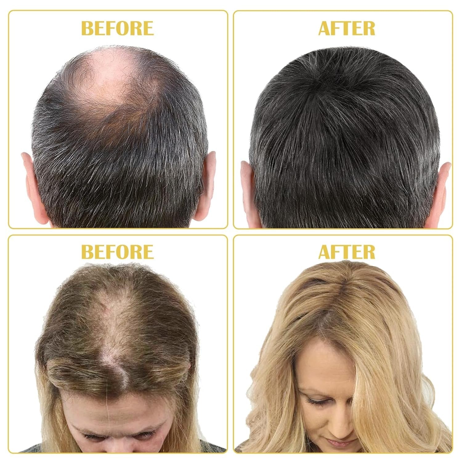 Biologische haargroeiolie 5% - Oplossing voor extern gebruik - Haargroei en verdikking - Voor haarverlies bij mannen en dunner wordend haar - Reactiveert krimpende follikels - Nauwkeurige pompdispenser, 60 ml haarverzorging Naty Shop