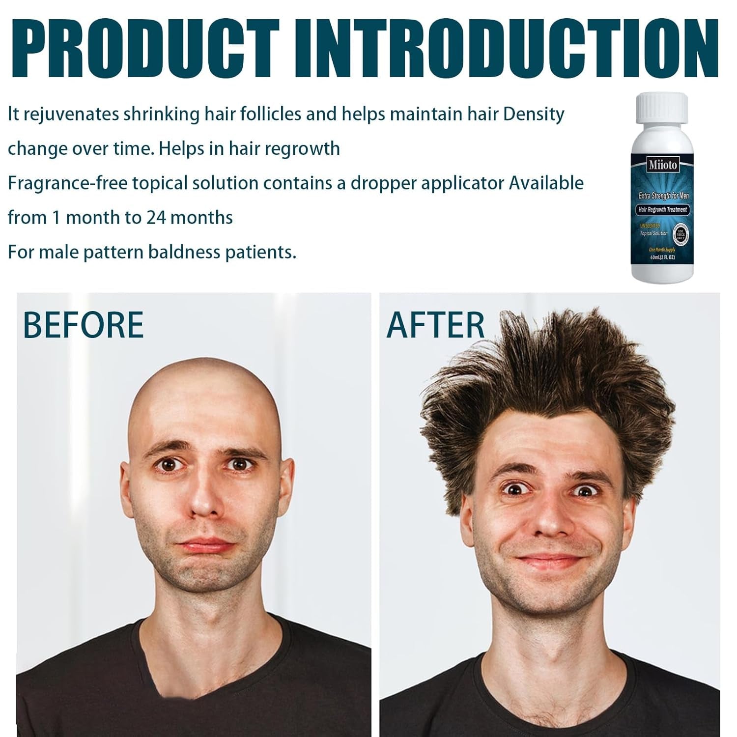 Miioto Haargroeiserum Haargroeiproduct voor mannen Haargroei Haarserum Hoofdhuidverzorging Dikker haar bevorderen Hoofdhuid voeden Haaruitval voorkomen 3*60ML Haarverzorging Naty Shop