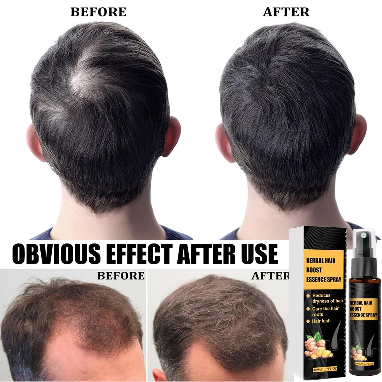 Geavanceerde haargroeibehandelingskit 30 ml 2 STUKS Haargroeispray Haargroeiroller en essentieset Haargroeiserum Anti-haaruitval Geavanceerd haargroeiserum Haarverzorging Naty Shop