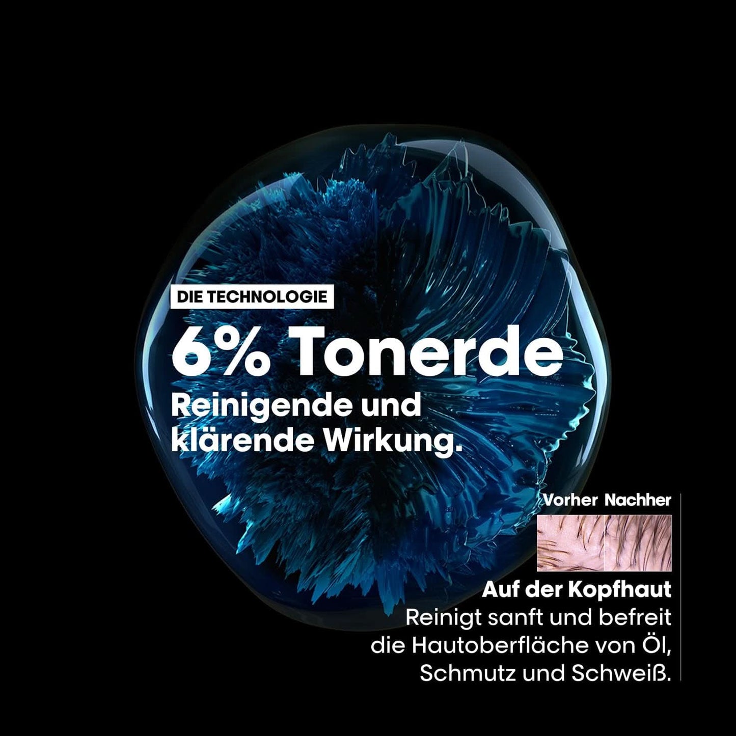 L'Oréal Professionnel Vette hoofdhuidreinigingsshampoo, 300 ml Naty Shop Douche en bad