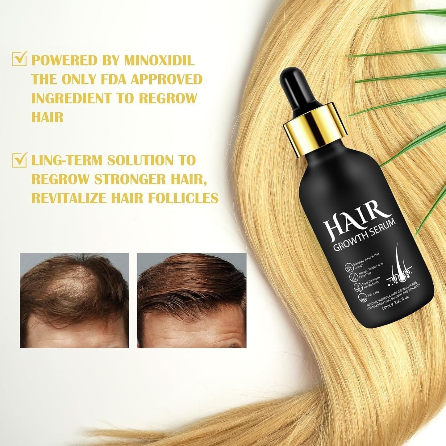 Biologische haargroeiolie 5% - Oplossing voor extern gebruik - Haargroei en verdikking - Voor haarverlies bij mannen en dunner wordend haar - Reactiveert krimpende follikels - Nauwkeurige pompdispenser, 60 ml haarverzorging Naty Shop