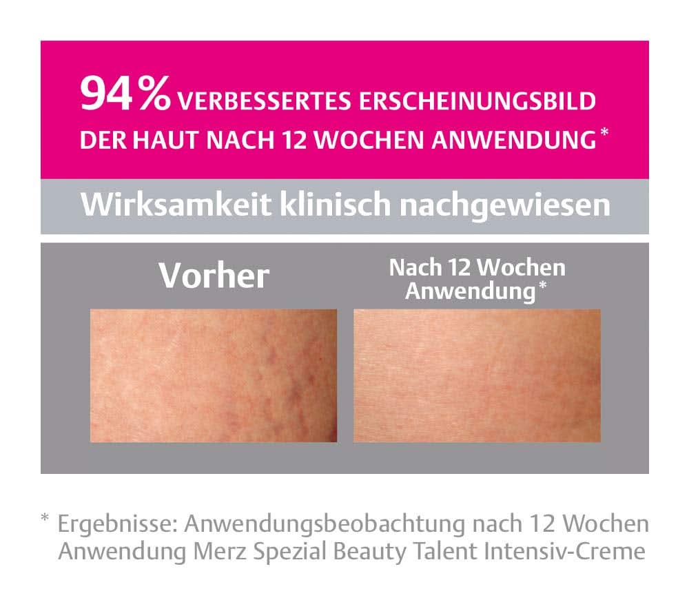 Merz Spezial, Intensieve crème voor striae, 75 ml Cosmetica en schoonheid Naty Shop