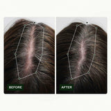 Scandinavische Biolabs haargroeiroutine voor vrouwen met klinisch bewezen resultaten in 45 dagen | Behandeling van haaruitval (Bio-Pilixin) Naty Shop Haarverzorging
