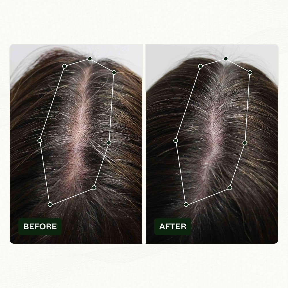 Scandinavische Biolabs haargroeiroutine voor vrouwen met klinisch bewezen resultaten in 45 dagen | Behandeling van haaruitval (Bio-Pilixin) Naty Shop Haarverzorging