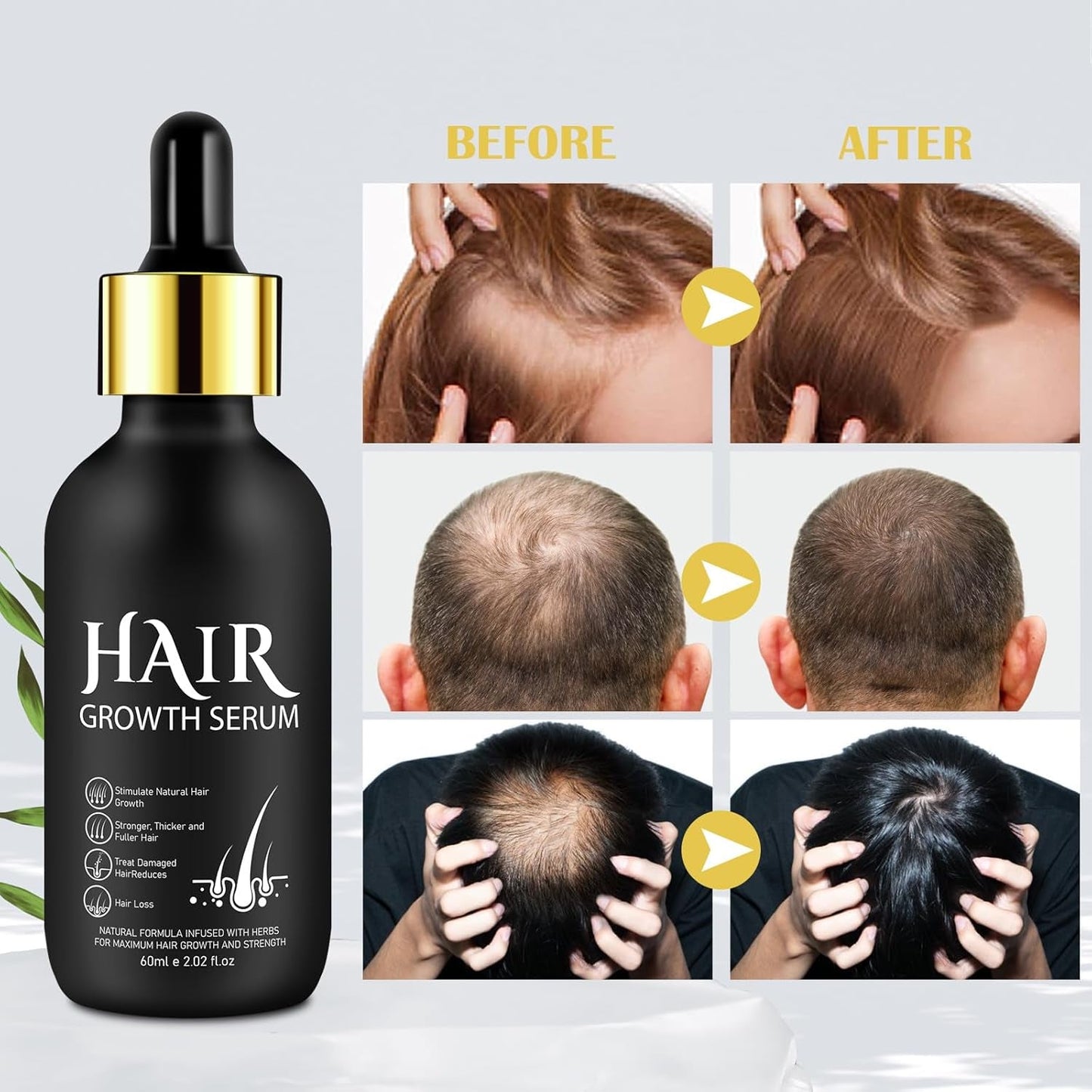 Biologische haargroeiolie 5% - Oplossing voor extern gebruik - Haargroei en verdikking - Voor haarverlies bij mannen en dunner wordend haar - Reactiveert krimpende follikels - Nauwkeurige pompdispenser, 60 ml haarverzorging Naty Shop