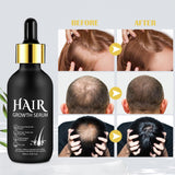 Biologische haargroeiolie 5% - Oplossing voor extern gebruik - Haargroei en verdikking - Voor haarverlies bij mannen en dunner wordend haar - Reactiveert krimpende follikels - Nauwkeurige pompdispenser, 60 ml haarverzorging Naty Shop