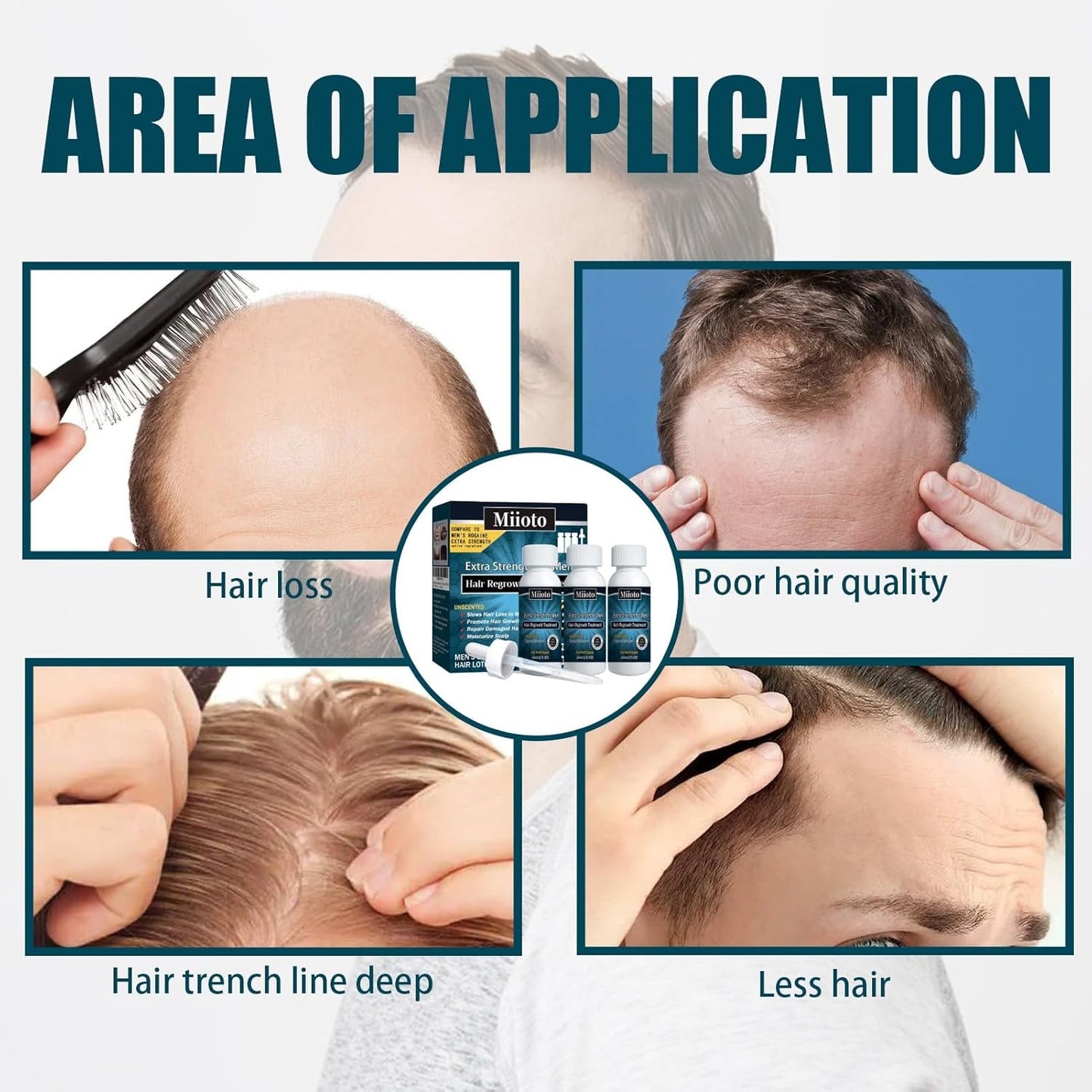 Miioto Haargroeiserum Haargroeiproduct voor mannen Haargroei Haarserum Hoofdhuidverzorging Dikker haar bevorderen Hoofdhuid voeden Haaruitval voorkomen 3*60ML Haarverzorging Naty Shop