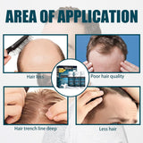 Miioto Haargroeiserum Haargroeiproduct voor mannen Haargroei Haarserum Hoofdhuidverzorging Dikker haar bevorderen Hoofdhuid voeden Haaruitval voorkomen 3*60ML Haarverzorging Naty Shop