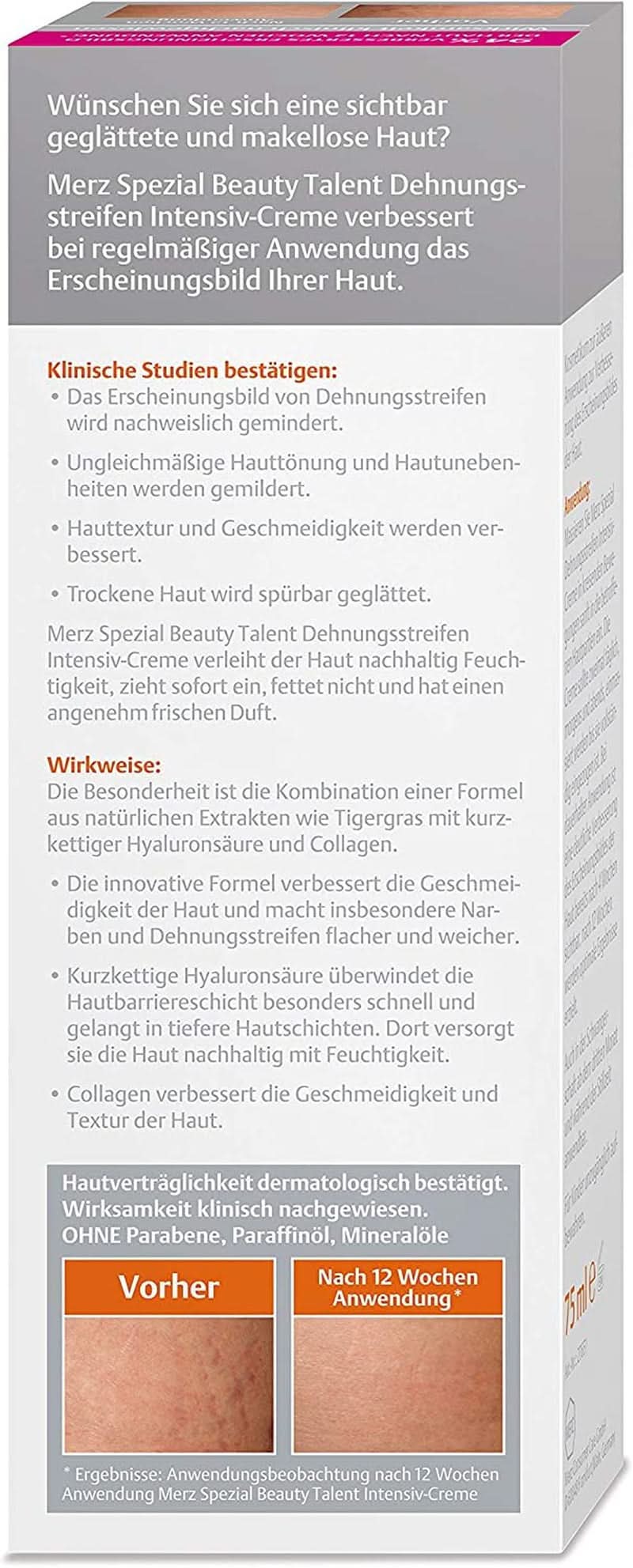 Merz Spezial, Intensieve crème voor striae, 75 ml Cosmetica en schoonheid Naty Shop