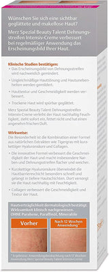Merz Spezial, Intensieve crème voor striae, 75 ml Cosmetica en schoonheid Naty Shop