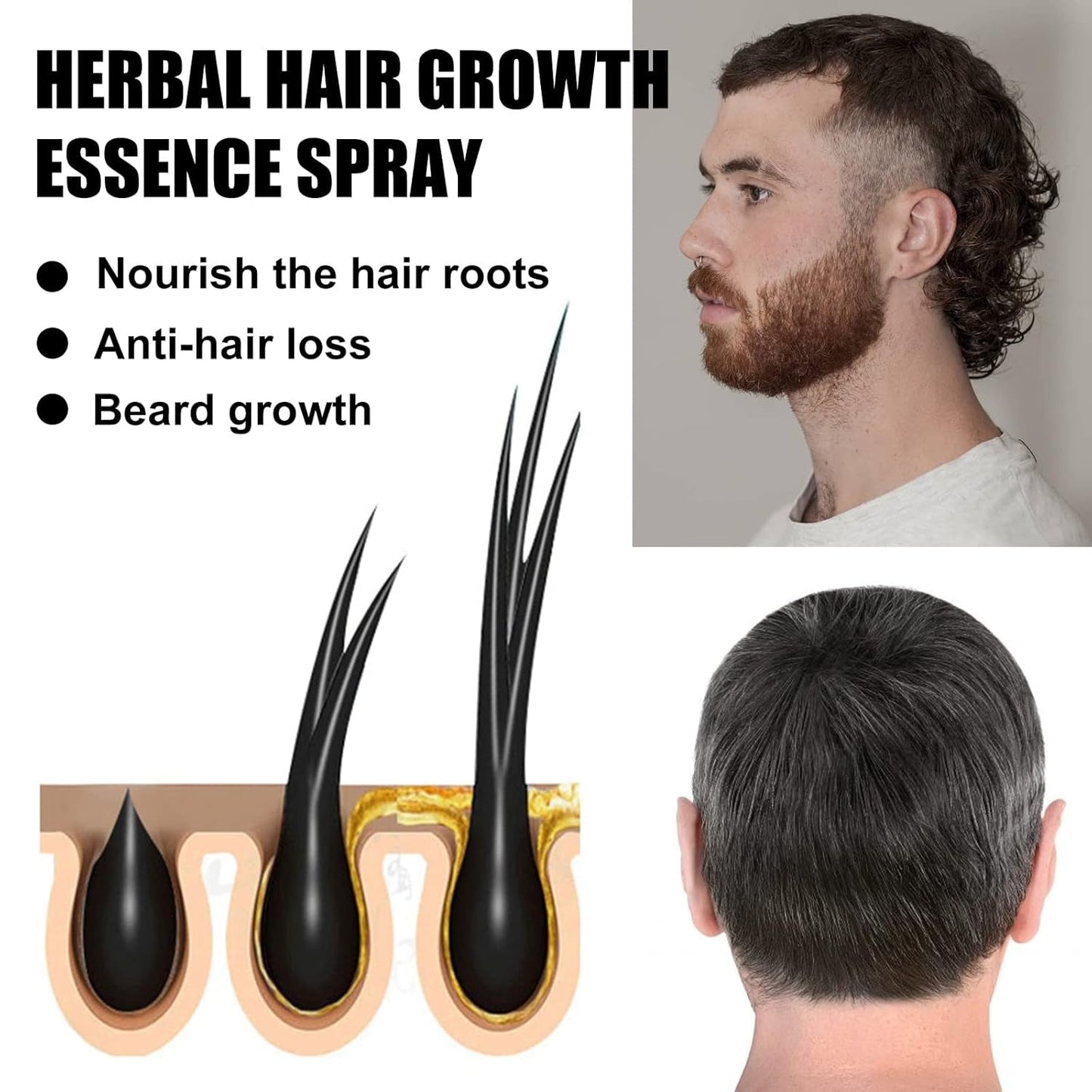 Geavanceerde haargroeibehandelingskit 30 ml 2 STUKS Haargroeispray Haargroeiroller en essentieset Haargroeiserum Anti-haaruitval Geavanceerd haargroeiserum Haarverzorging Naty Shop